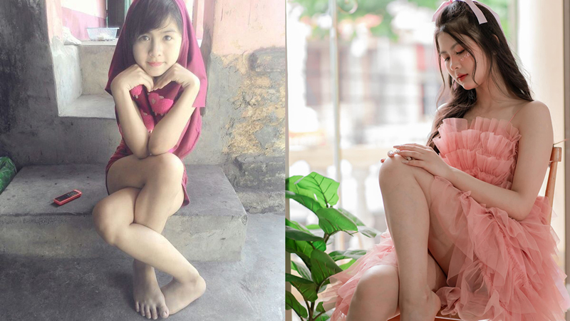 8 năm sau bức ảnh "chân khoèo" gây bão mạng xã hội, cuộc sống của hot girl Hải Dương giờ ra sao?